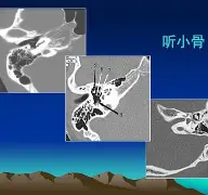 关于S疋:镫u?eM馗E?